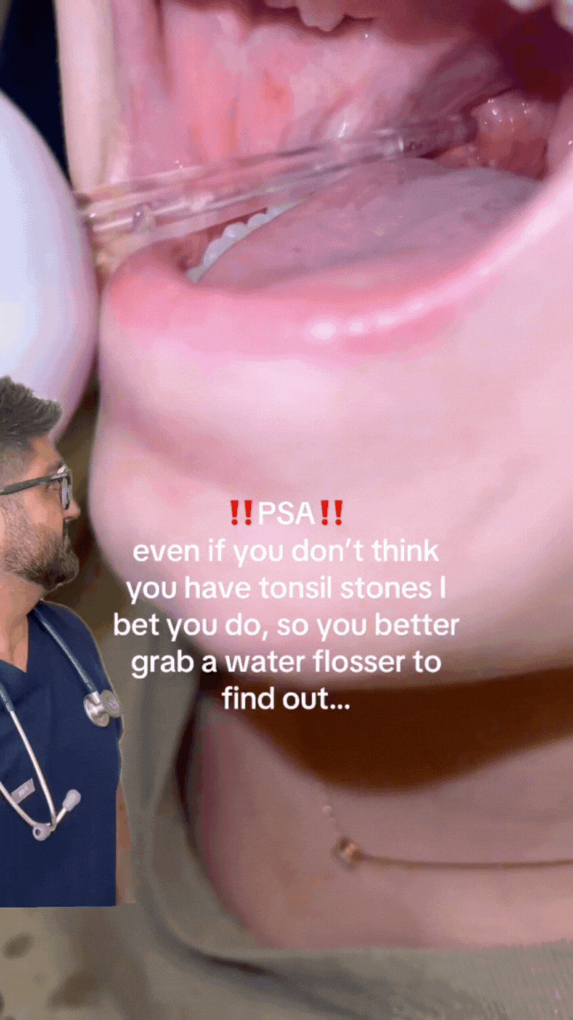TikTok-doctorsooj-Can_you_remove_tonsil_stones_with_a_water_flosser_health_gross_to..._7437601592137862433_.mp4.gif