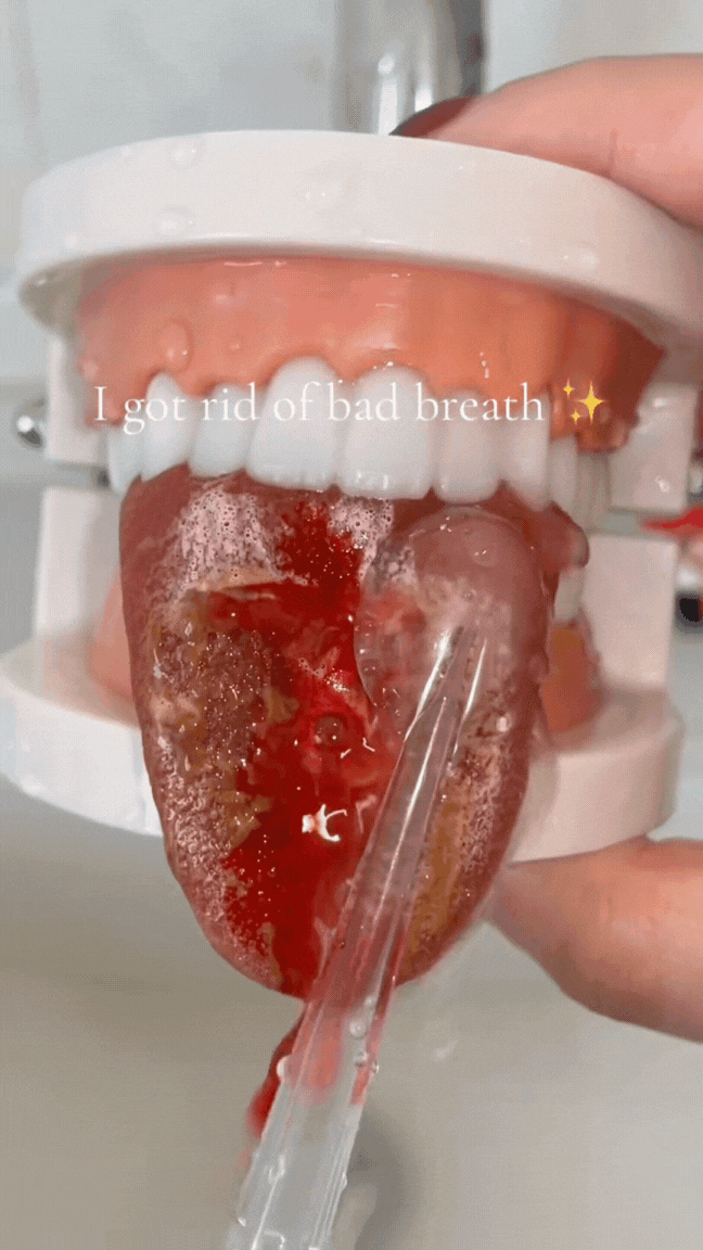 TikTok-doctorsooj-Can_you_remove_tonsil_stones_with_a_water_flosser_health_gross_to..._7437601592137862433_.mp4_4.gif