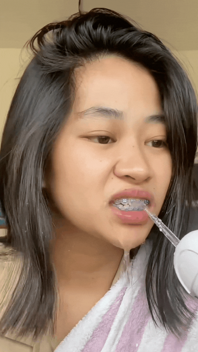 TikTok-doctorsooj-Can_you_remove_tonsil_stones_with_a_water_flosser_health_gross_to..._7437601592137862433_.mp4_4_c30f9d01-7afc-459b-9efa-61c5fc6616c2.gif